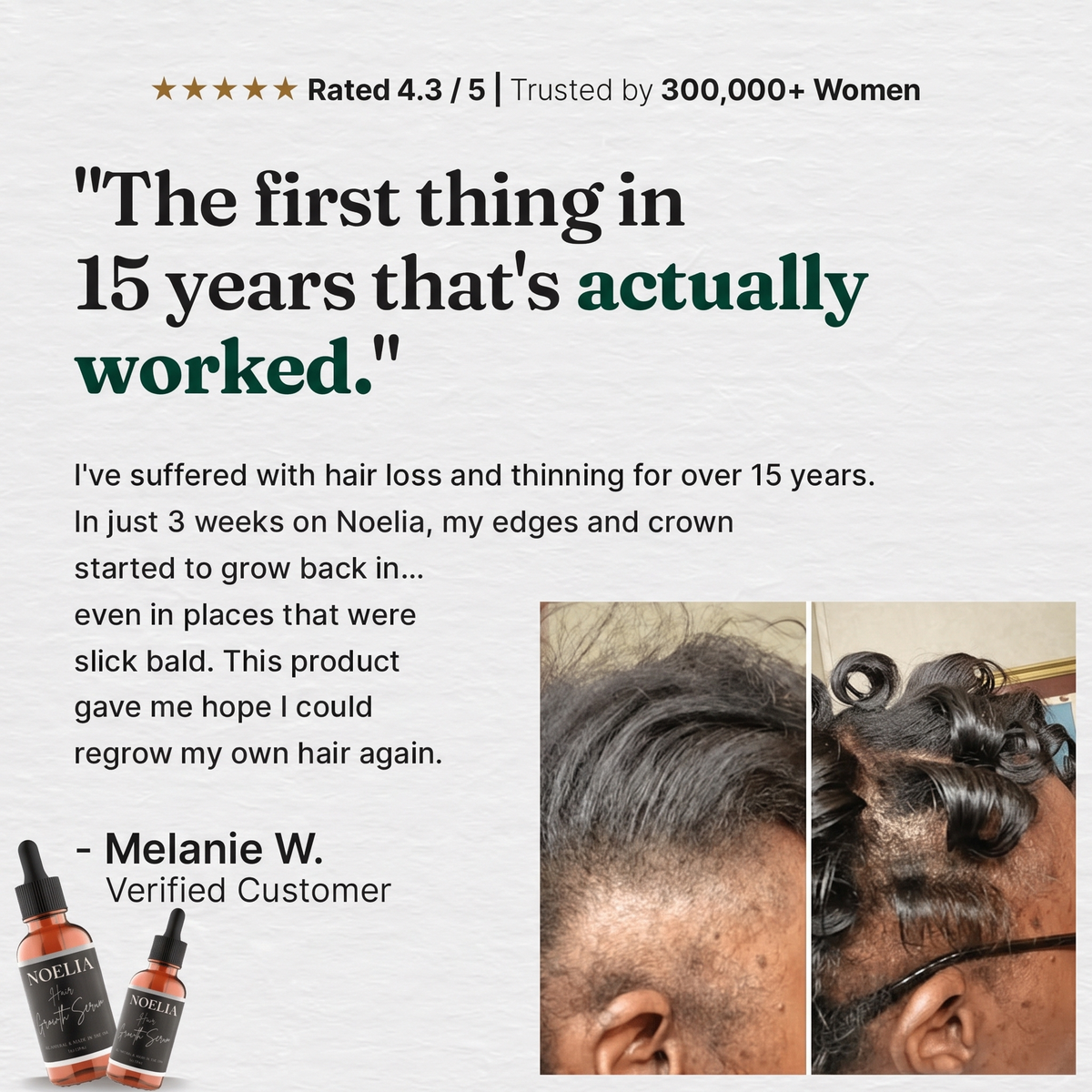 Hair Growth Serum